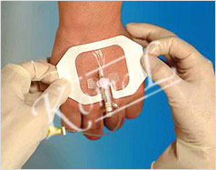 Manufacturers Exporters and Wholesale Suppliers of Sterile Post Operative Transparent Dressing (PU) Pune Maharashtra